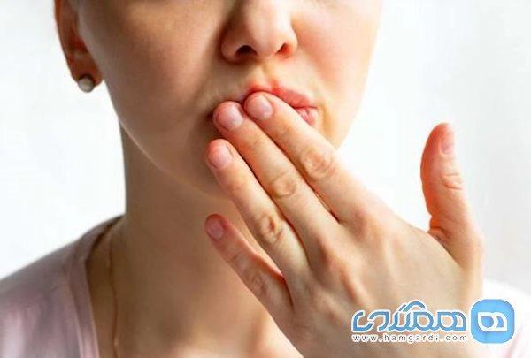 لب هایتان درباره سلامتی بدن شما چه می گویند؟